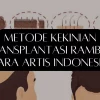 Metode Kekinian Transplantasi Rambut Para Artis Indonesia